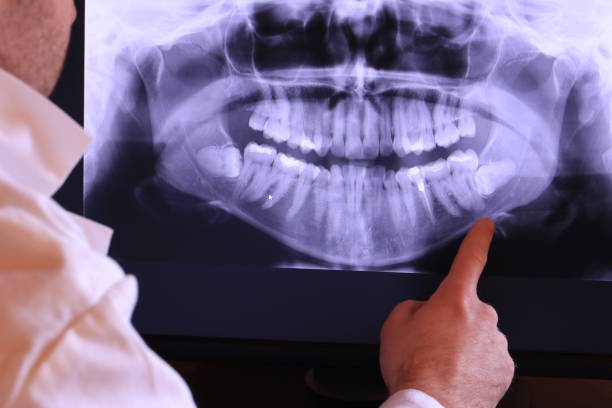 Best Urgent Dental Care for Toothaches in Fate, TX